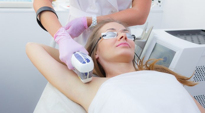 Лазерная эпиляция в Киеве